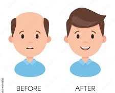 Hair Regrowth  Understanding the Problem and Finding Real Solutions